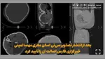 انسیه خزعلی: سال گذشته به خاطر فوت ناگهانی یک زن جوان دروغ‌های زیادی منتشر شد و عضویت ایران از کمیسیون مقام زن را لغو کردند