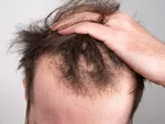 ۵ ماده غذایی سرشار از ویتامین D