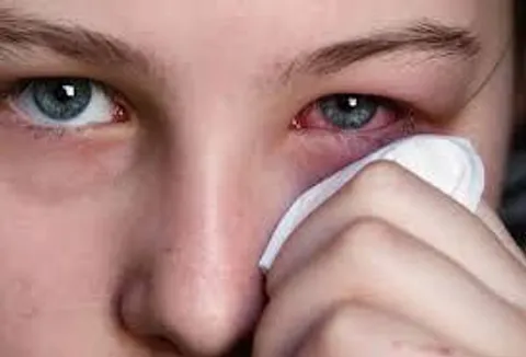 چرا چشم‌ها در پاییز حساس‌تر می‌شوند؟؛ بررسی دلایل و راهکارها