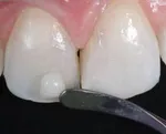 ماده غذایی که مرگ ناگهانی و آلزایمر را از شما دور می‌کند