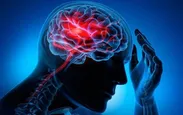 دلایل افزایش سکته مغزی در میان جوانان