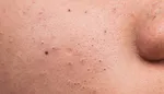با این خوردنی‌ها کلیه هایتان را پاکسازی کنید
