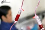 نکاتی درباره تالاسمی ماژور از زبان فوق تخصص بیماری‌های خون