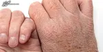 راهکارهای پیشگیری از عوارض رنگ کردن مو