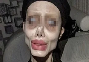 عکس/ اینستاگرام سیاه‌پوش شد
