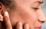 امکان پیشگیری از ۶۰ درصد کم‌شنوایی‌ها| از سکته گوش چه می‌دانیم؟