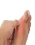 تمام چاق‌ها کبد چرب ندارند