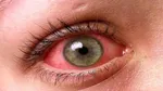 این قطره شما را از عینک مطالعه بی‌نیاز می‌کند