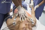 دختر 15 ساله انگلیسی زنده‌زنده سوخت