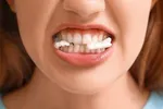 8 دليل قانع كننده برای ترك آدامس