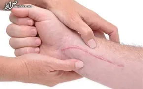 کاریکاتور/ کاپ جام جهانی خون‌آلود شد