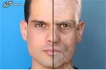 چطور دست‌هایتان را جوان نگه دارید؟