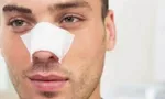 پشت پرده استقبال از شیوه‌های جدید جراحی زیبایی