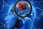 ۷ دلیل شگفت انگیز برای مصرف روغن زیتون