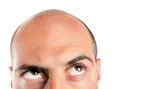 علائم جذام چیست؟