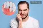 نحوه مراقبت از دندان‌های شیری و دائمی کودکان پس از وارد شدن ضربه