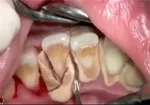 تجمع دندانپزشکان مقابل وزارت بهداشت