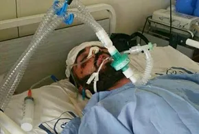 فیلم | حادثه هولناک برای دوچرخه‌سوار ایرانی در مسابقات جهانی