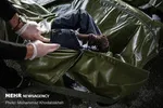 مرگ تلخ دختر ۱۵ ساله پس از تجویز غلط قرص‌های درمان جوش صورت!
