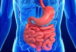 خارج کردن توده ۷.۵کیلویی از شکم زنی در تبریز