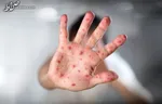 گردش آنفلوآنزا در کشور به کجا رسید؟