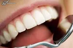 چرا بلافاصله بعد از غذا نباید مسواک بزنیم؟