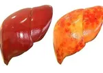 ۱۰ گزینه غذایی قلب را جوان نگه می‌دارند