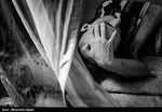 هر آنچه که باید درباره قارچ پوستی و راه‌های پیشگیری از آن بدانید