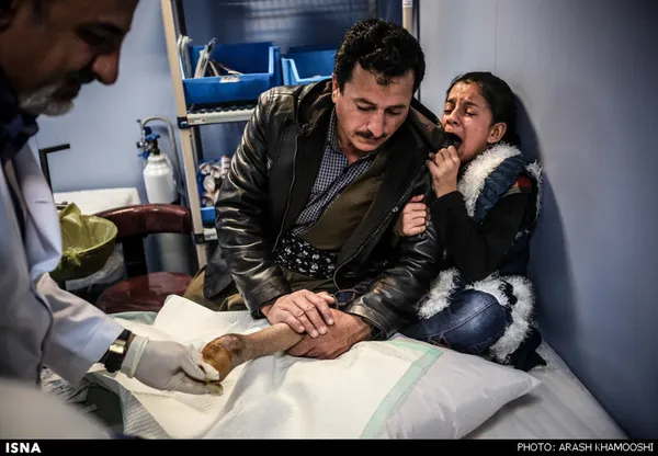 پزشک به کمک پدر گشین در حال خارج کردن پلاتین از پای اوست. پای گشین که در پی انفجار مین قطع شده، تاکنون سه بار تحت عمل جراحی قرار گرفته است.