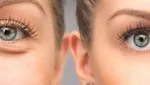 ۱۱ ماده غذایی مناسب برای سلامت پوست