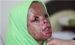 شین‌آبادی ها: بعد از ۶ سال می‌گویند، خوب نمی‌شوید!