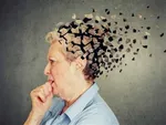 مغز دلفین‌ها تغییراتی شبیه آلزایمر را نشان می‌دهد
