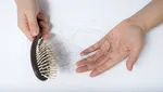 ریزش موی ناشی از کرونا دائمی خواهد بود؟