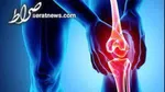 پری بیوتیک‌ها به تسکین درد آرتروز کمک می‌کنند