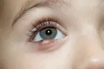 چهار عامل اصلی خشکی مو چیست؟