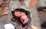 تازه‌ترین وضعیت نوزاد پیدا شده در سطل زباله نازی آباد
