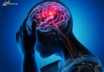 مهمترین علامت‌های بیماری پارکینسون
