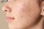 این مکمل استرس را نابود می‌کند