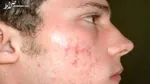 تمیز کردن کاشی‌های حمام با ۲ روش خانگی