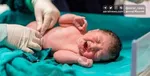 زایمان طبیعی ایمن‌ترین روش زایمان در دنیا | آمار سقط‌های غیرقانونی در کشور