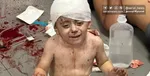 بیمارستان‌های غزه هر ساعت پذیرای ۵۰ شهید و زخمی جدید هستند