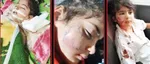 یک کودک مسجدسلیمانی بر اثر حمله سگ‌های ولگرد جان باخت