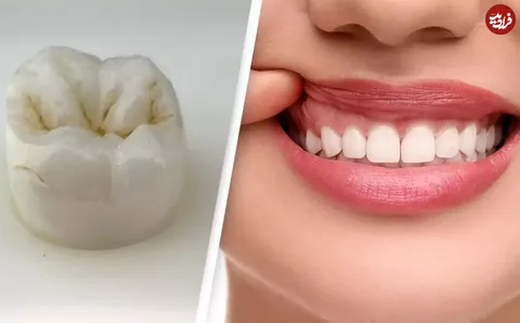 ۶ سال دیگر صبر کنید؛ دندان‌هایتان دوباره درمی‌آیند!