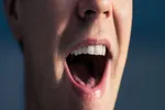 سرطان دهان چیست و چه بخش‌هایی را درگیر می‌کند؟