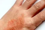 ۱۱ ماده غذایی مناسب برای سلامت پوست