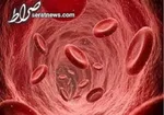 کمبود ۱۰۰ قلم دارو در استان کرمانشاه