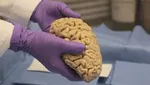 دلایل اصلی مرگ و میر تهرانی‌ها در سال گذشته چه بود؟ +عکس