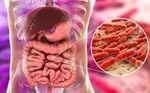 تاثیر شگفت‌آور یک ماده موجود در غذاهای پروتئینی‌ بر ترمیم روده