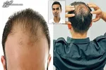 حقایق عجیبی که ژن‌های پشت اثر انگشت فاش می‌کنند
