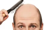 ۶ علت اصلی ریزش مو